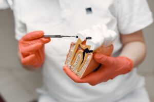 Read more about the article Leczenie zębów u dorosłych – najczęstsze problemy i dostępne metody